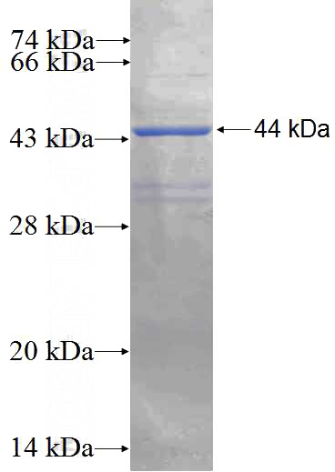 Recombinant Human TAF12 SDS-PAGE