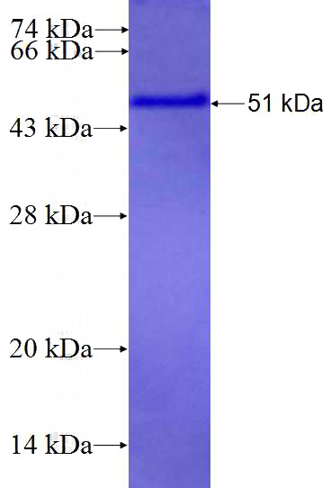 Recombinant Human NACC2 SDS-PAGE