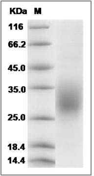 Rat CD83 Protein (His Tag) SDS-PAGE