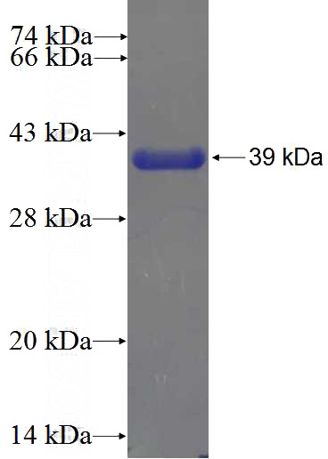 Recombinant Human ZNF641 SDS-PAGE