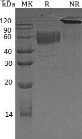 Human CD83 (Fc tag) recombinant protein