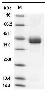 Human CD23 / FCER2 Protein (His Tag) SDS-PAGE