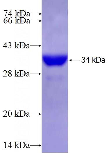 Recombinant Human FAM109B SDS-PAGE