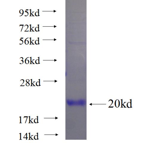 Recombinant human SPANXN4 SDS-PAGE
