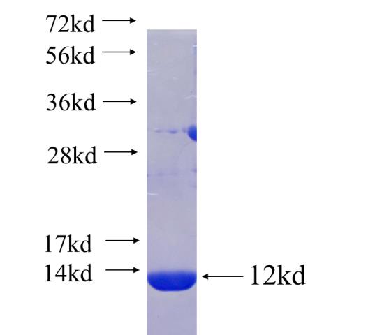 Recombinant human VWC2 SDS-PAGE