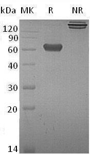 Human TNFRSF9/CD137/ILA (Fc tag) recombinant protein