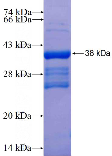 Recombinant Human CD151 SDS-PAGE