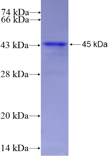 Recombinant Human INA SDS-PAGE