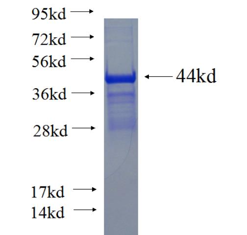 Recombinant human TJAP1 SDS-PAGE