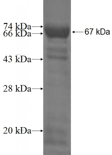 Recombinant Human MAGEB1 SDS-PAGE