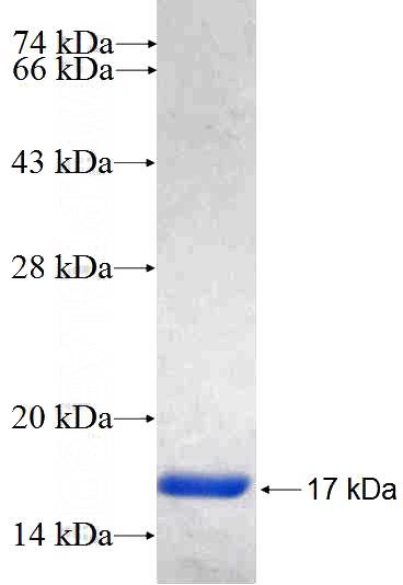 Recombinant Human TGM6 SDS-PAGE