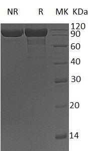Human CFB/BF/BFD (His tag) recombinant protein