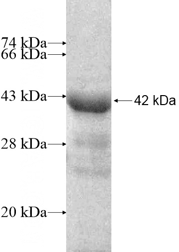 Recombinant Human ABCE1 SDS-PAGE