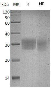 Human CD7 (His tag) recombinant protein