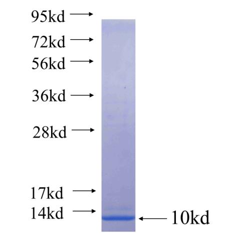 Recombinant human SLCO1B3 SDS-PAGE