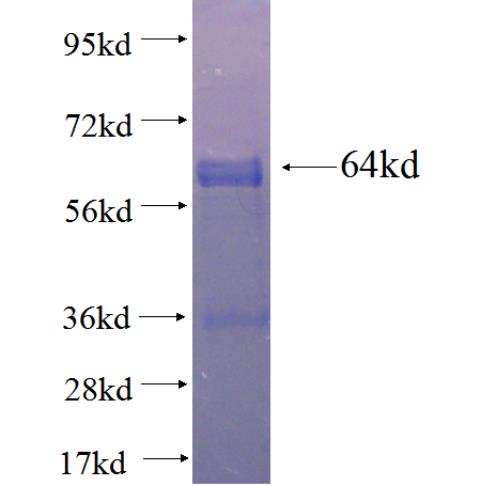 Recombinant human AOAH SDS-PAGE