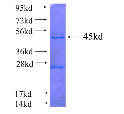 Recombinant human LAS1L SDS-PAGE
