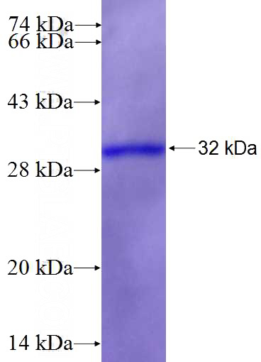 Recombinant Human DRD4 SDS-PAGE