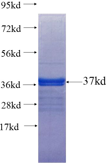 Recombinant Human RASD2 SDS-PAGE