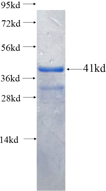 Recombinant Human GTF3C2 SDS-PAGE