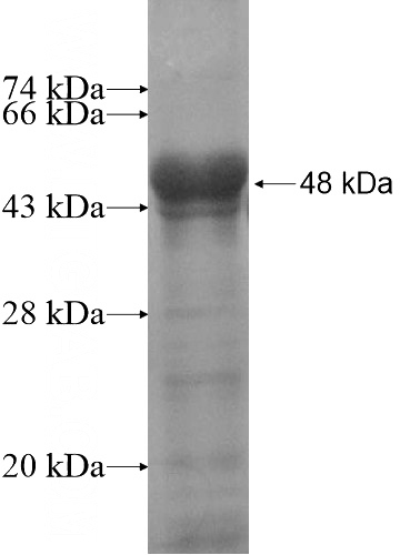 Recombinant Human ZNF295 SDS-PAGE