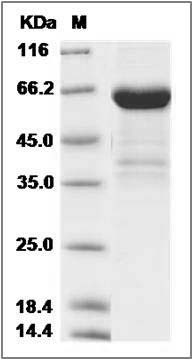 Rat CD23 / FCER2 / FCER2A Protein (Fc Tag) SDS-PAGE