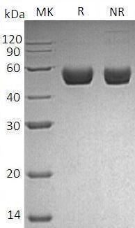 Mouse Ren1/Ren/Ren-1 (His tag) recombinant protein