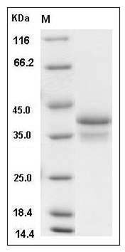 Mouse Resistin / ADSF / RETN Protein (Fc Tag) SDS-PAGE