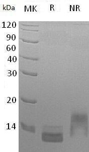 Human CCL14/NCC2/SCYA14 (His tag) recombinant protein