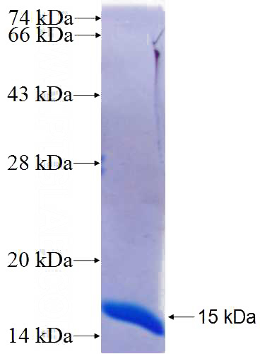 Recombinant Human LIM2 SDS-PAGE