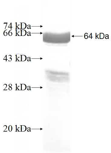 Recombinant Human AP2B1 SDS-PAGE