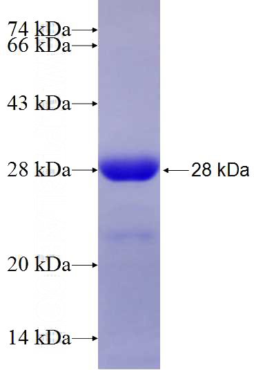 Recombinant Human GIT2 SDS-PAGE