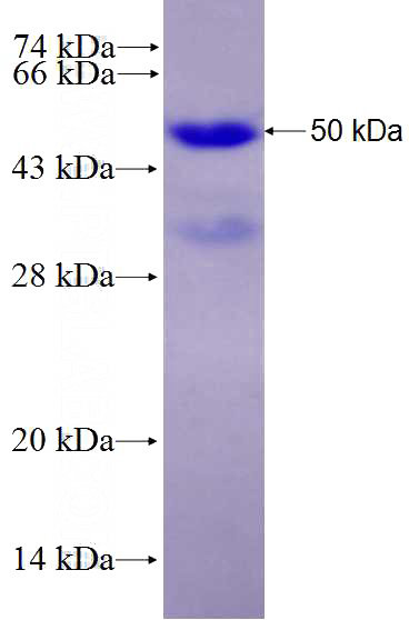 Recombinant Human BZRAP1 SDS-PAGE