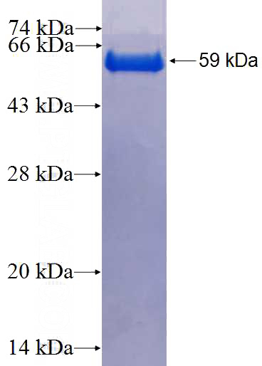 Recombinant Human CPEB3 SDS-PAGE