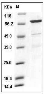 Human CDC37 / CDC37A Protein (GST Tag) SDS-PAGE