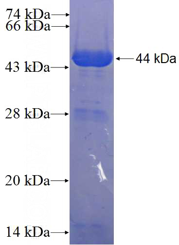 Recombinant Human FAM35A SDS-PAGE