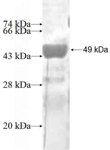 Recombinant Human ARL15 SDS-PAGE