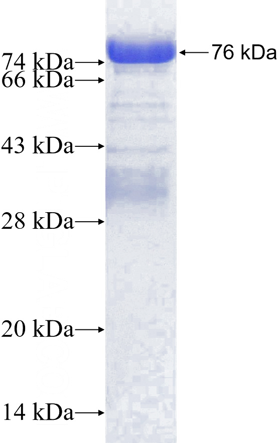 Recombinant Human SAFB2 SDS-PAGE