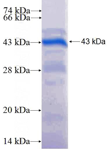 Recombinant Human MYF6 SDS-PAGE