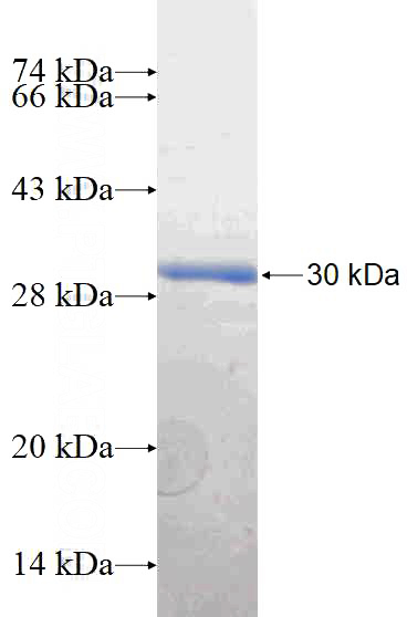 Recombinant Human PIK3CB SDS-PAGE