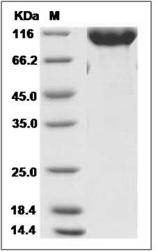 Rat CSF1R / MCSF Receptor / CD115 Protein (Fc Tag) SDS-PAGE