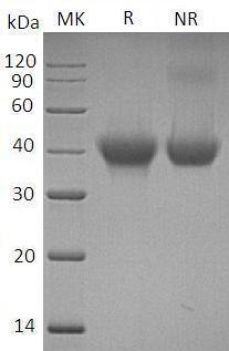 Human IL5RA/IL5R (His tag) recombinant protein
