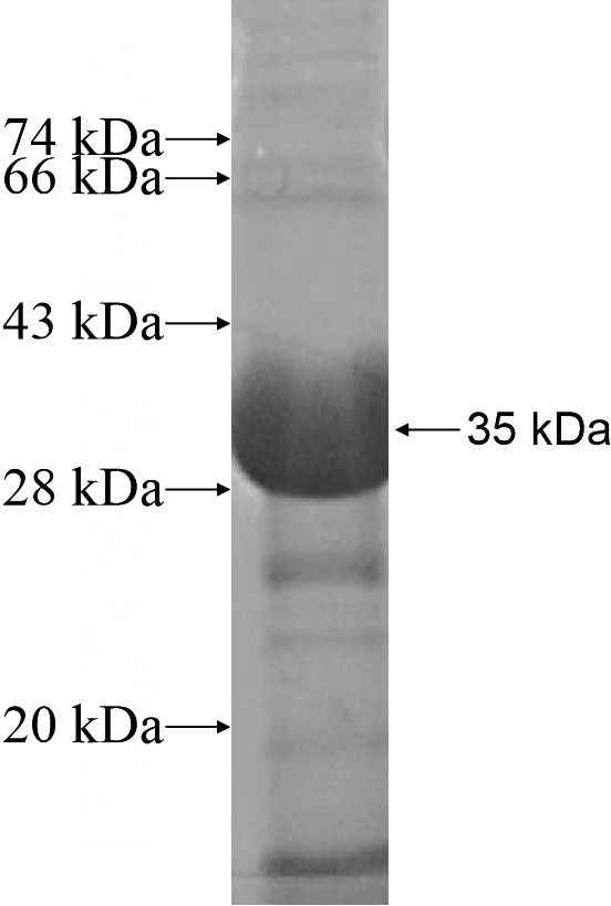 Recombinant Human CCDC70 SDS-PAGE