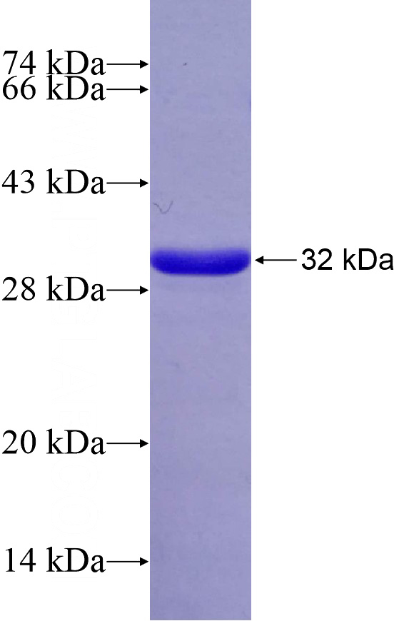 Recombinant Human SAMM50 SDS-PAGE