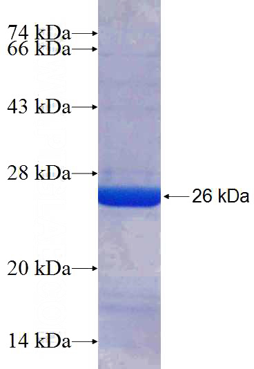 Recombinant Human MYEF2 SDS-PAGE