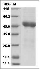 Human ST8SIA1 / GD3S Protein (His Tag)