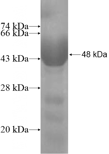 Recombinant Human AP1B1 SDS-PAGE