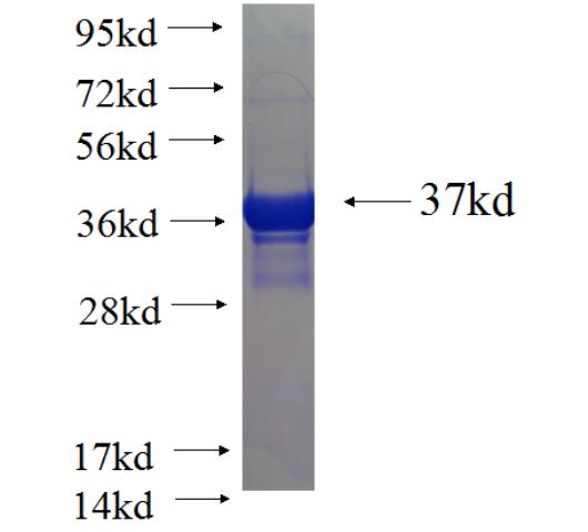 Recombinant human ING3 SDS-PAGE