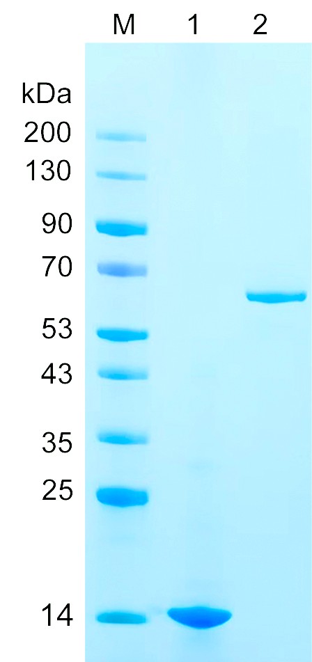 Recombinant RABP1 protein (His tag) SDS-PAGE
