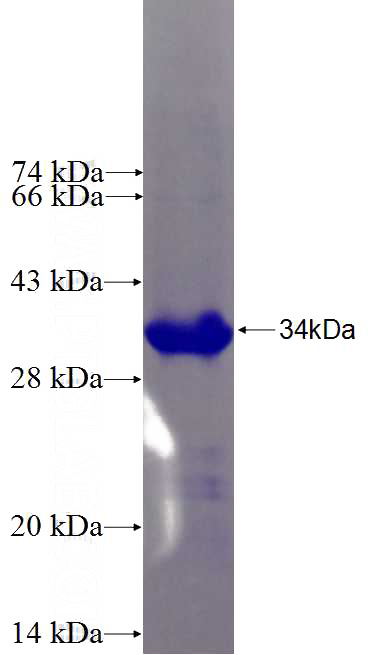 Recombinant Human NIPSNAP3A SDS-PAGE